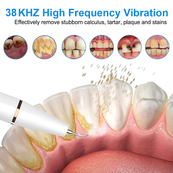 Royaleva Ultrasonic Scaler for Home Use 5